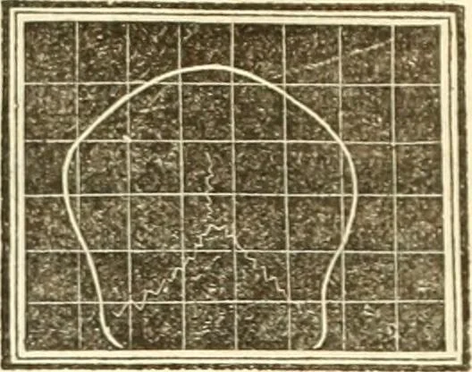 An illustration from A system of phrenology, 1839, leaf 169