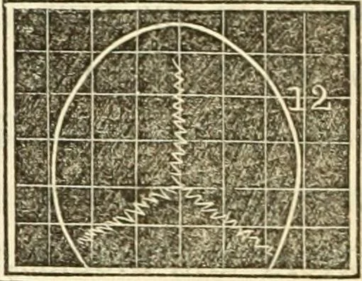 An illustration from A system of phrenology, 1839, leaf 255