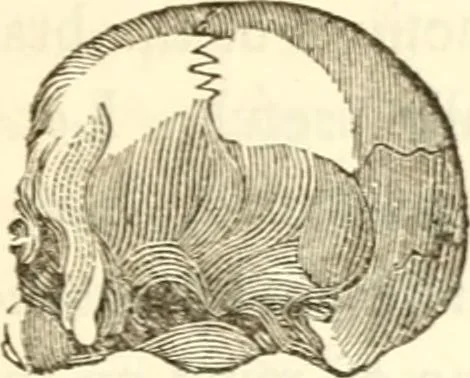 An illustration from A system of phrenology, 1839, leaf 52