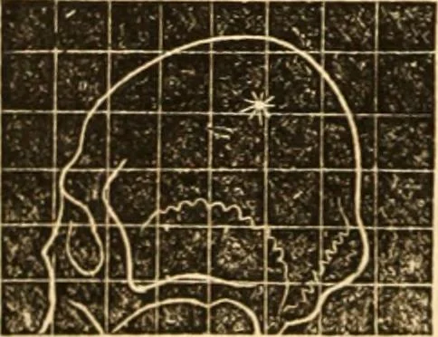 An illustration from A system of phrenology, 1839, leaf 593