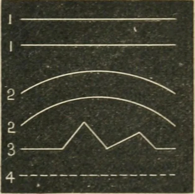 An illustration from Teacher's manual for freehand drawing in intermediate schools, 1876, leaf 40