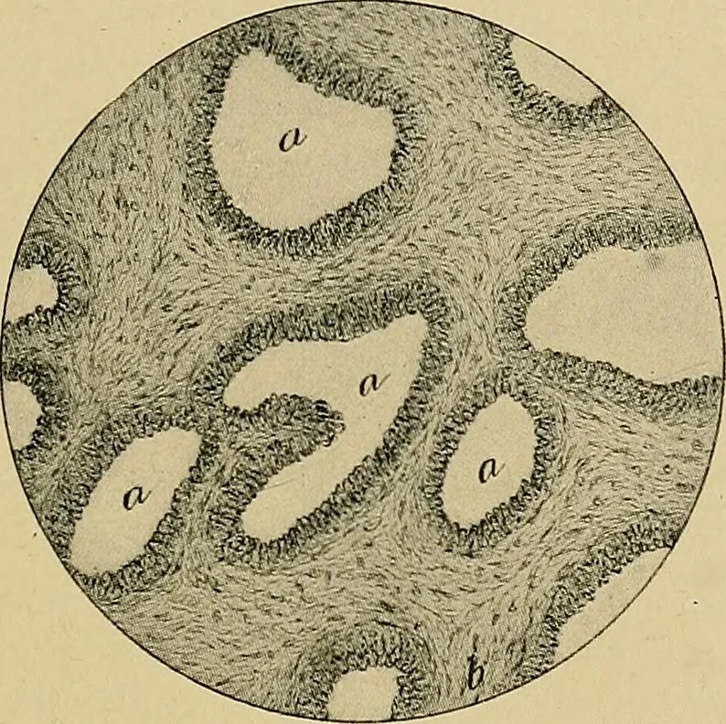 An illustration from A text-book of diseases of the nose and throat, 1904, leaf 224