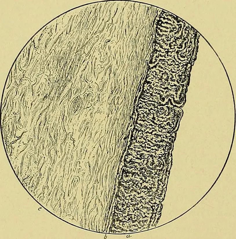 An illustration from A text-book of diseases of the nose and throat, 1904, leaf 245