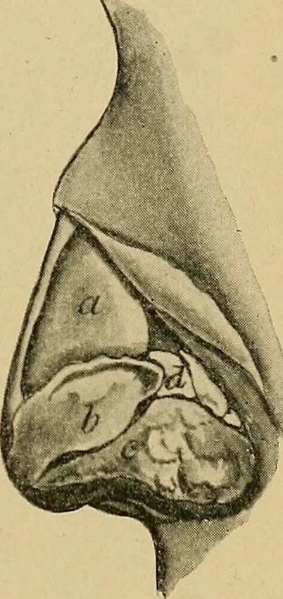 An illustration from A text-book of diseases of the nose and throat, 1904, leaf 26