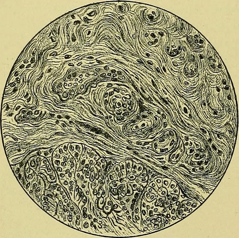 An illustration from A text-book of diseases of the nose and throat, 1904, leaf 261