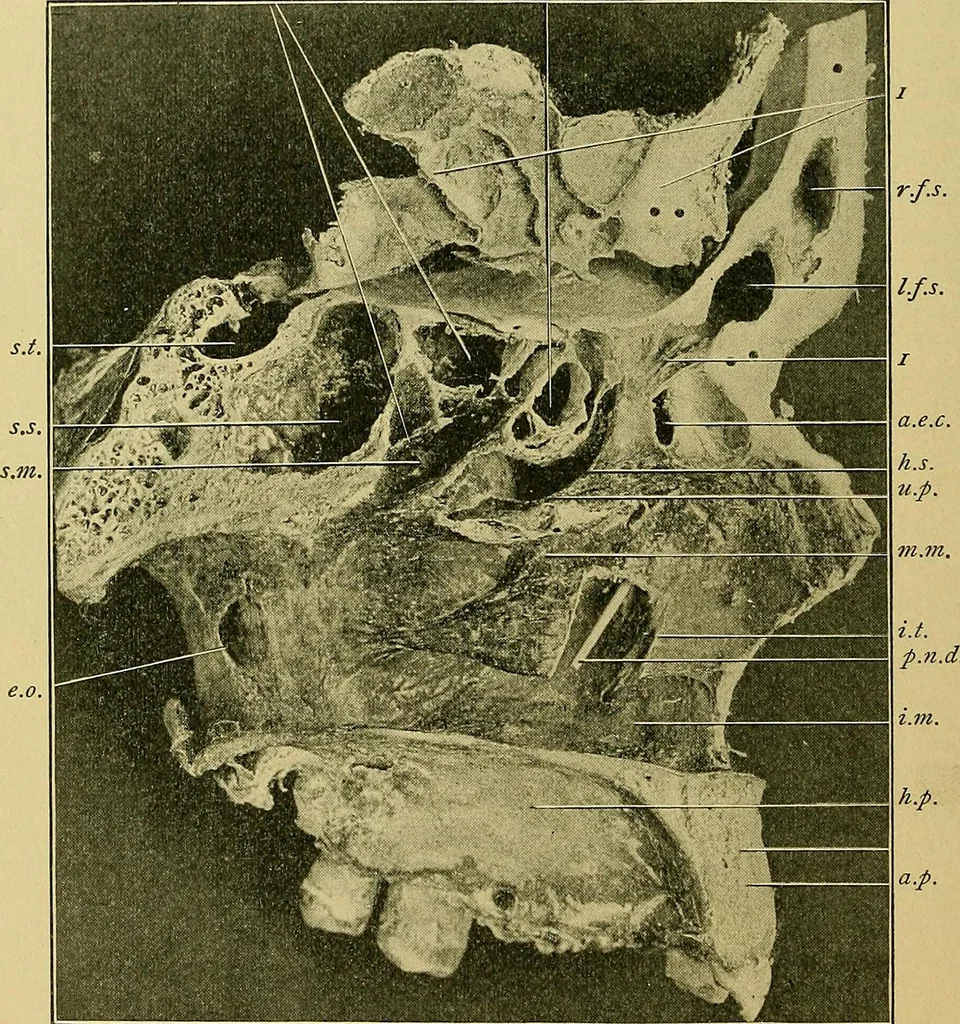 An illustration from A text-book of diseases of the nose and throat, 1904, leaf 27