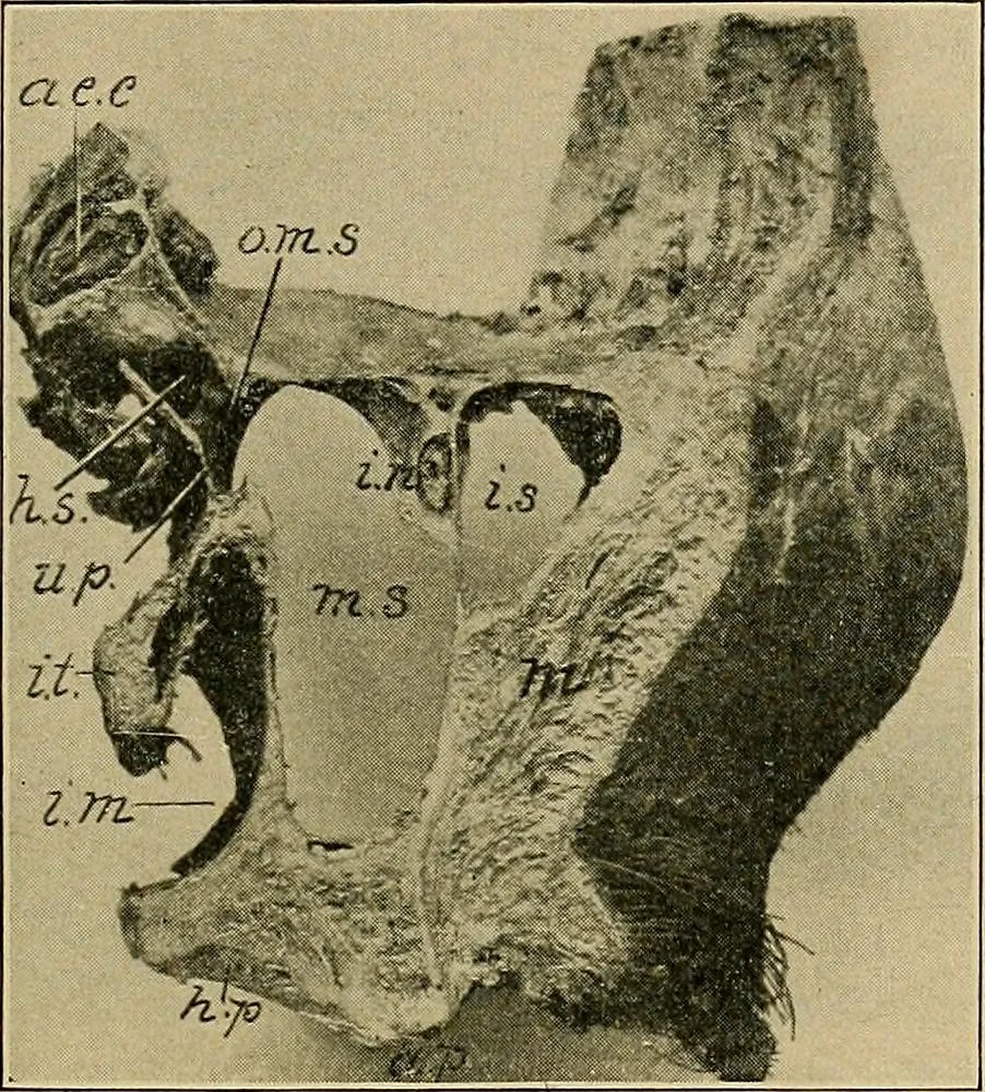 An illustration from A text-book of diseases of the nose and throat, 1904, leaf 304