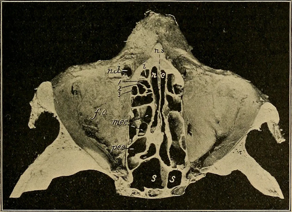 An illustration from A text-book of diseases of the nose and throat, 1904, leaf 326