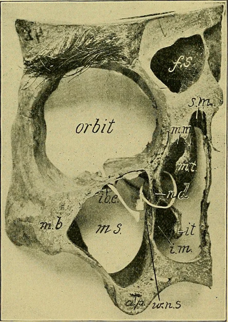 An illustration from A text-book of diseases of the nose and throat, 1904, leaf 351