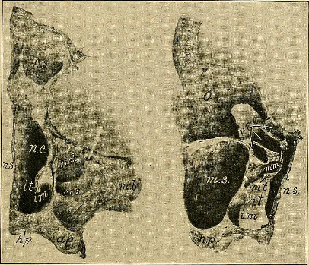 An illustration from A text-book of diseases of the nose and throat, 1904, leaf 352