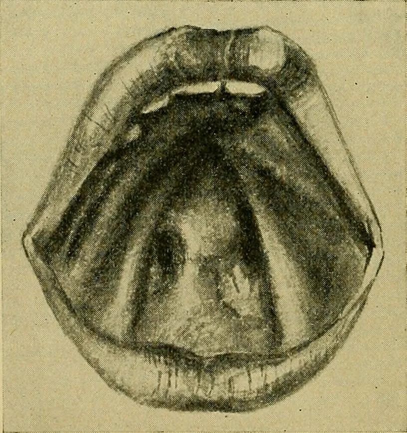 An illustration from A text-book of diseases of the nose and throat, 1904, leaf 367
