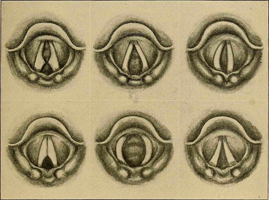 An illustration from A text-book of diseases of the nose and throat, 1904, leaf 618