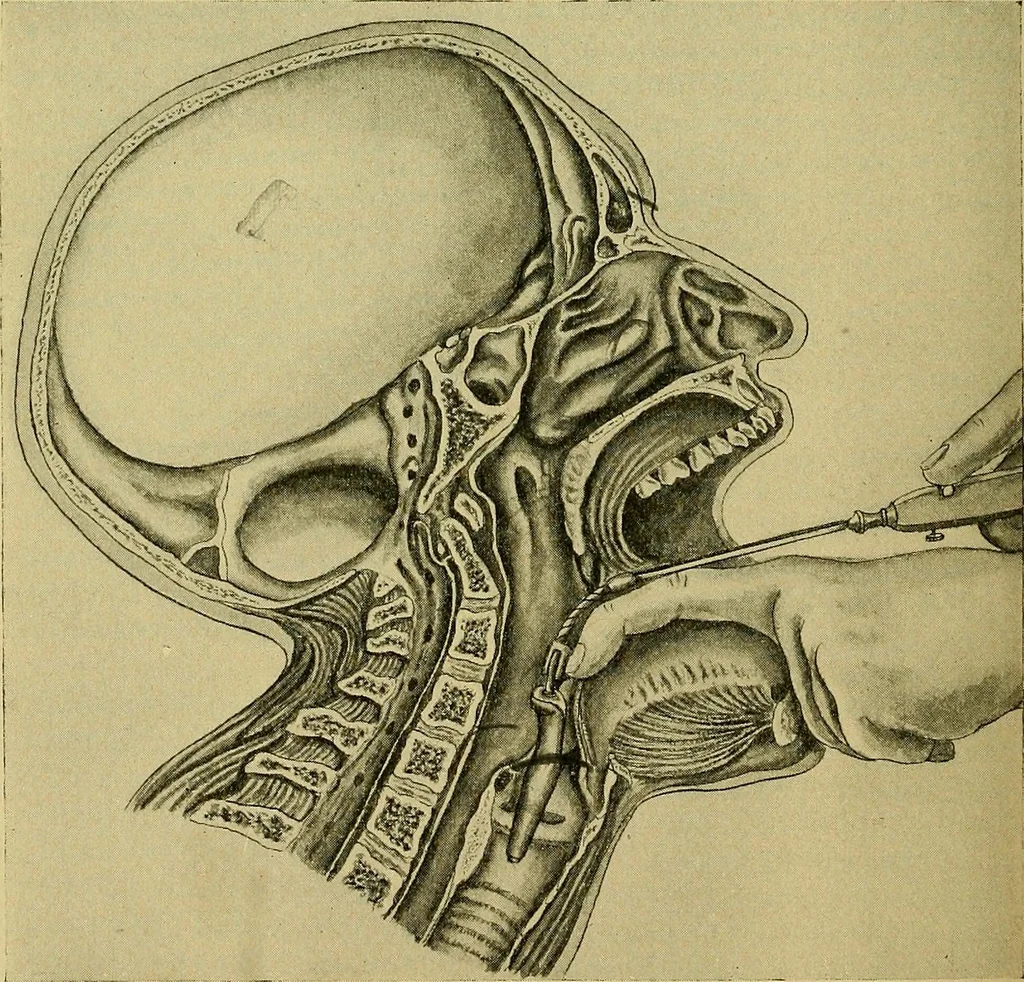 An illustration from A text-book of diseases of the nose and throat, 1904, leaf 625