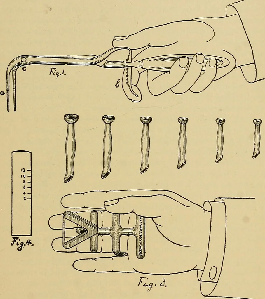 An illustration from A text-book of diseases of the nose and throat, 1904, leaf 628