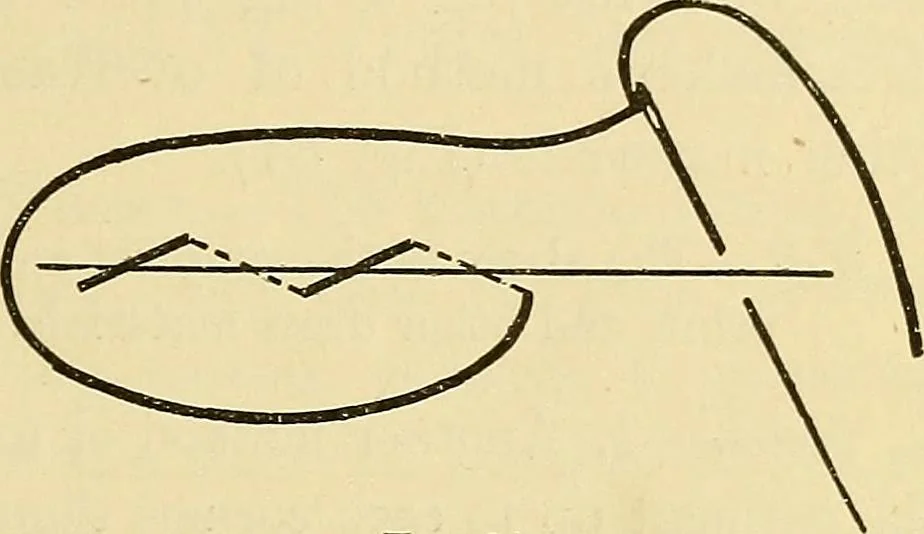 An illustration from A text-book of needlework, knitting and cutting out : with methods of teaching, 1893, leaf 208