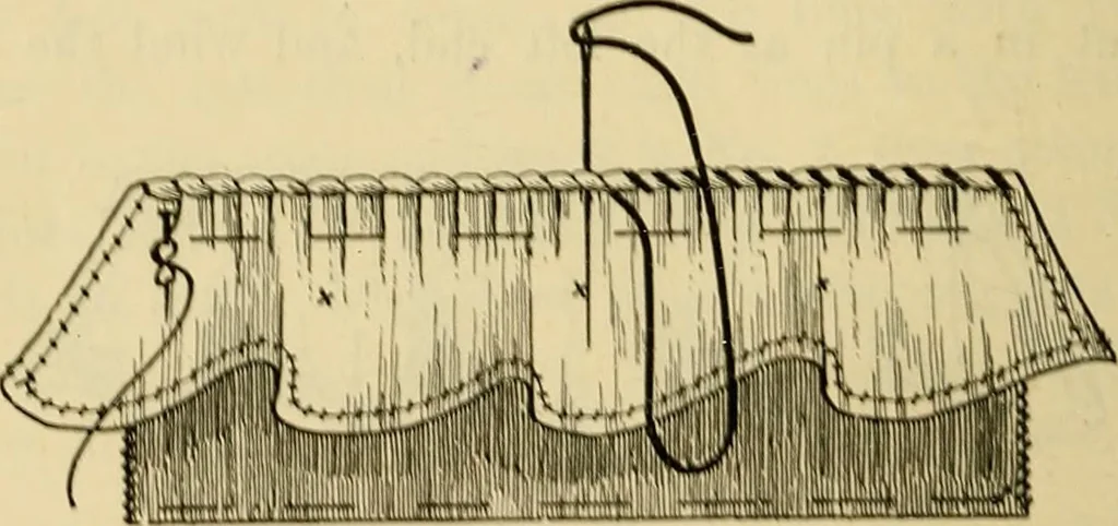 An illustration from A text-book of needlework, knitting and cutting out : with methods of teaching, 1893, leaf 225