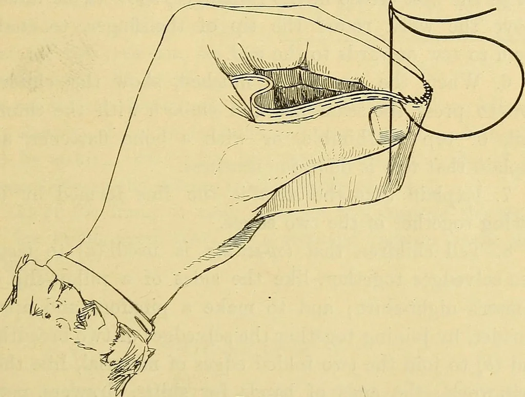 An illustration from A text-book of needlework, knitting and cutting out : with methods of teaching, 1893, leaf 68