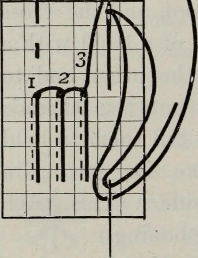 An illustration from A text-book of needlework, knitting, and cutting out : with methods of teaching, 1893, leaf 145