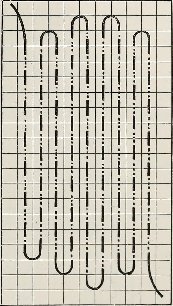 An illustration from A text-book of needlework, knitting, and cutting out : with methods of teaching, 1893, leaf 94