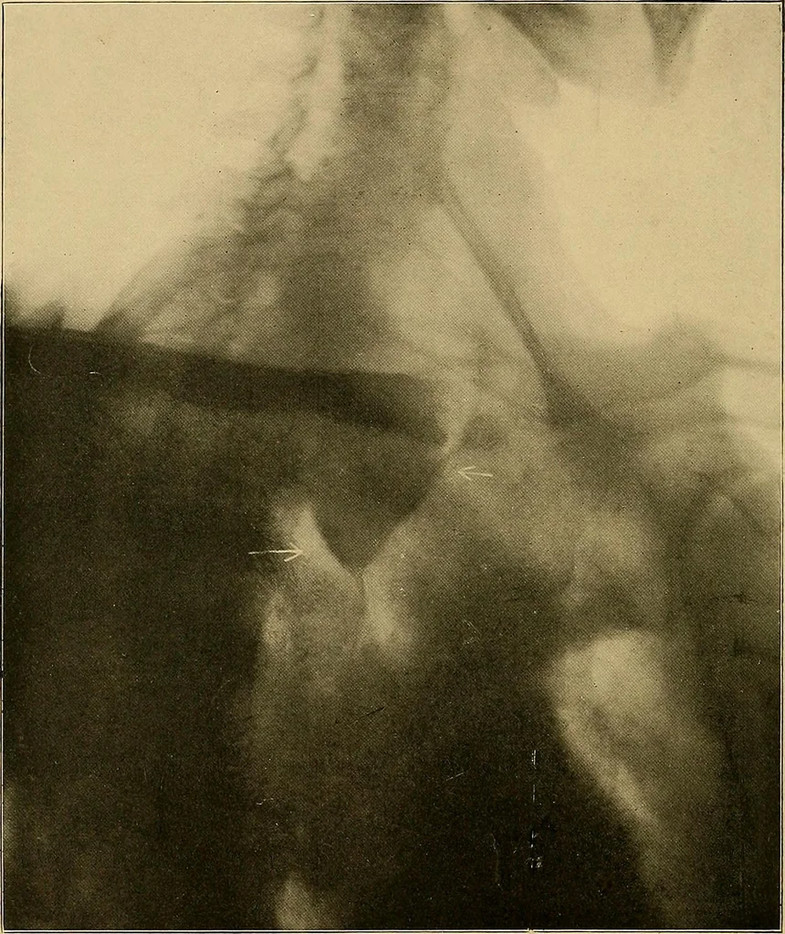 An illustration from A text-book of radiology, 1915, leaf 11