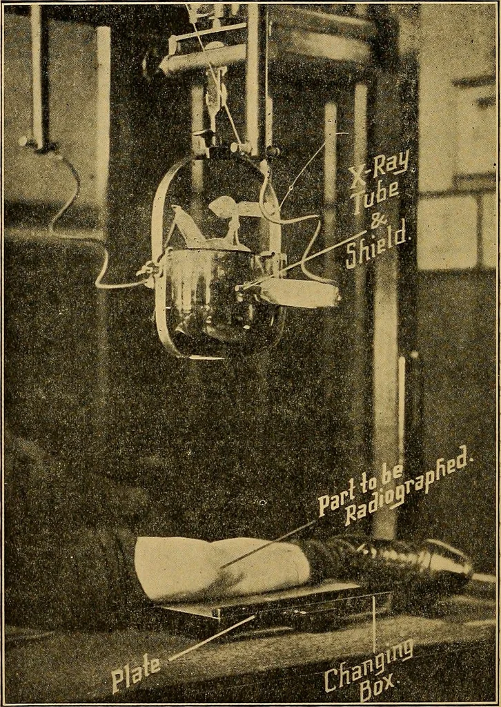 An illustration from A text-book of radiology, 1915, leaf 141