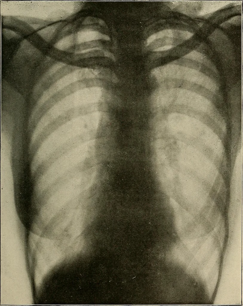 An illustration from A text-book of radiology, 1915, leaf 188