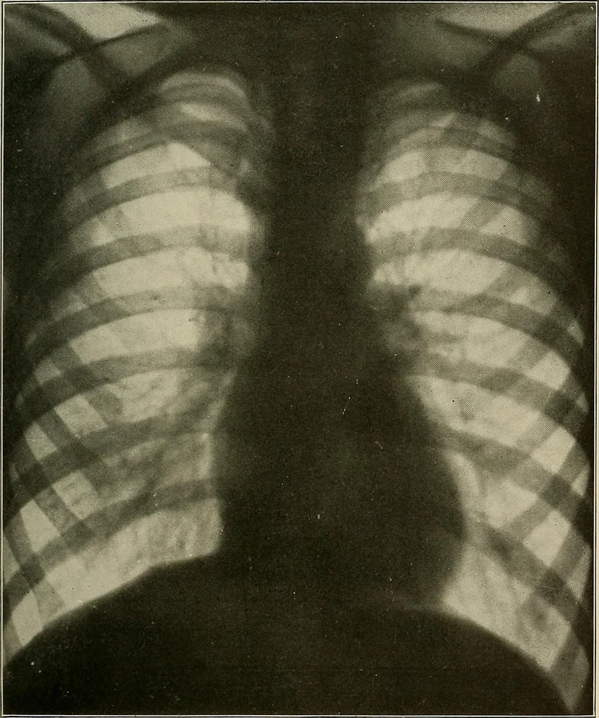 An illustration from A text-book of radiology, 1915, leaf 192