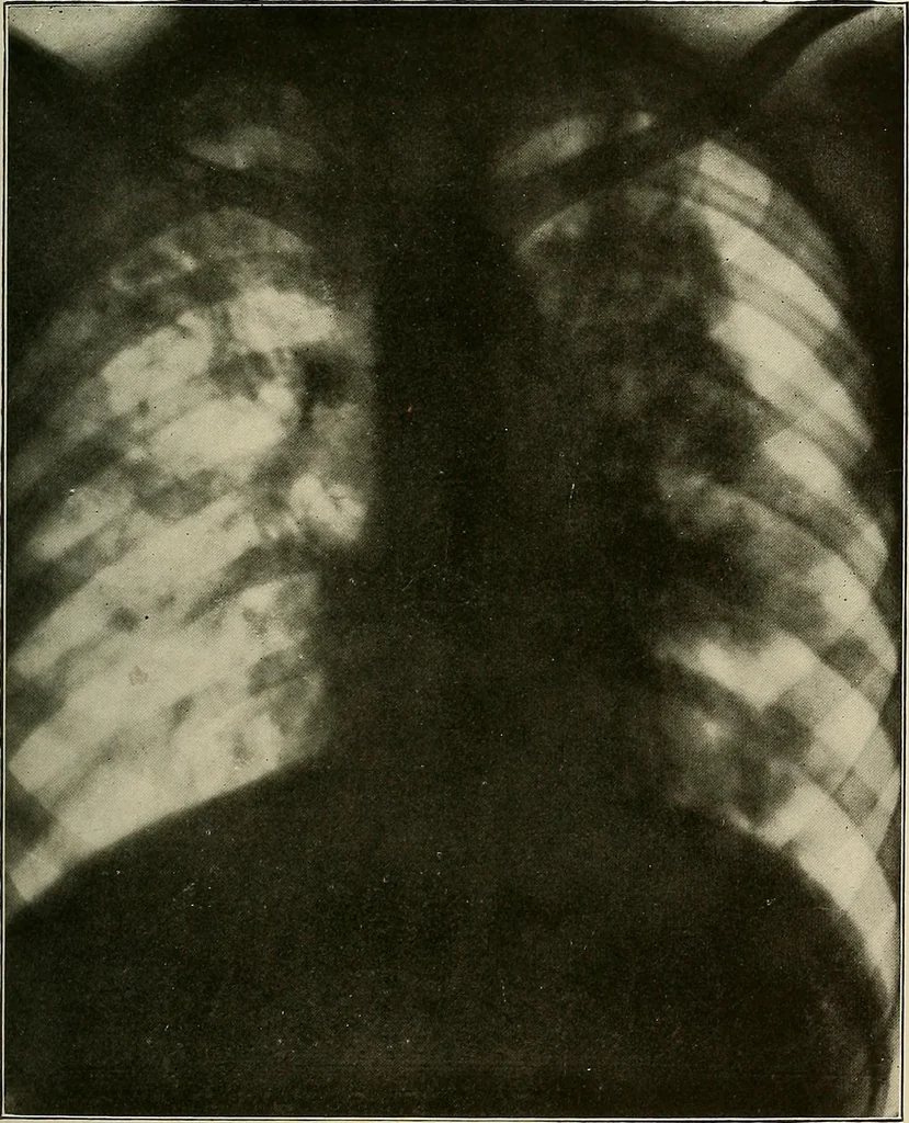An illustration from A text-book of radiology, 1915, leaf 194