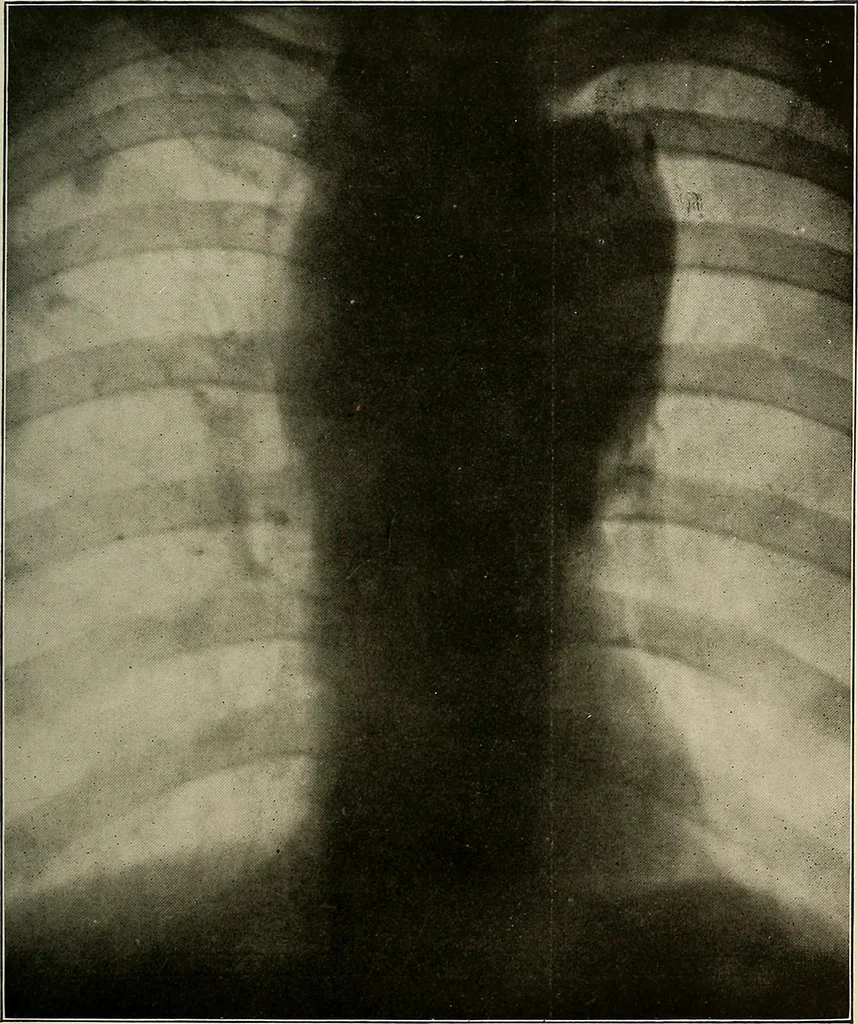 An illustration from A text-book of radiology, 1915, leaf 196