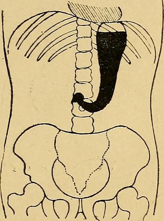 An illustration from A text-book of radiology, 1915, leaf 212