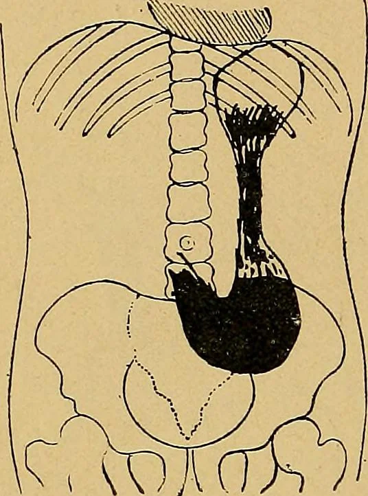 An illustration from A text-book of radiology, 1915, leaf 213