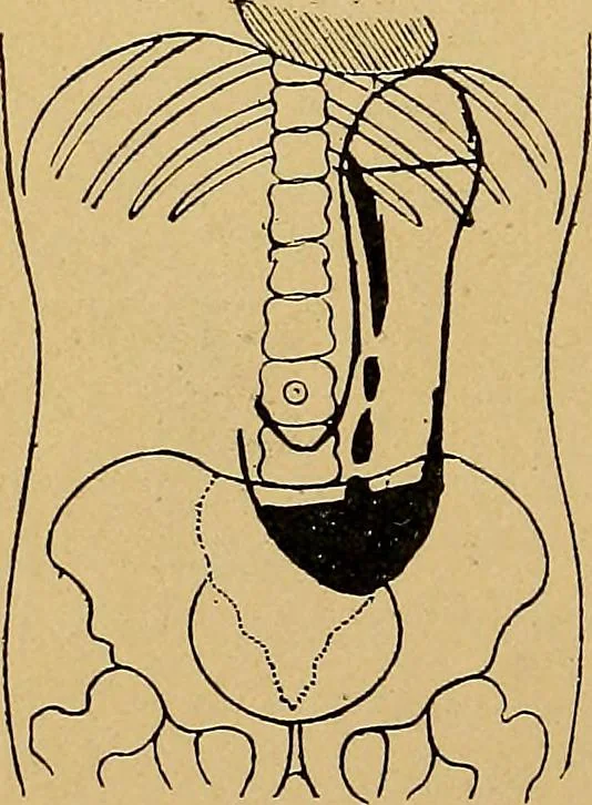 An illustration from A text-book of radiology, 1915, leaf 213