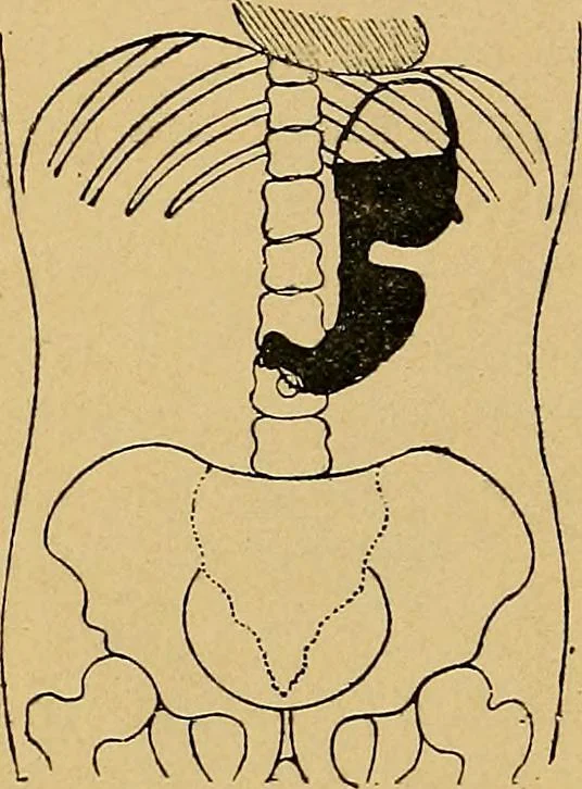 An illustration from A text-book of radiology, 1915, leaf 215
