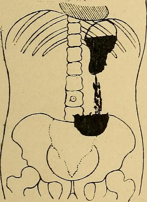 An illustration from A text-book of radiology, 1915, leaf 216