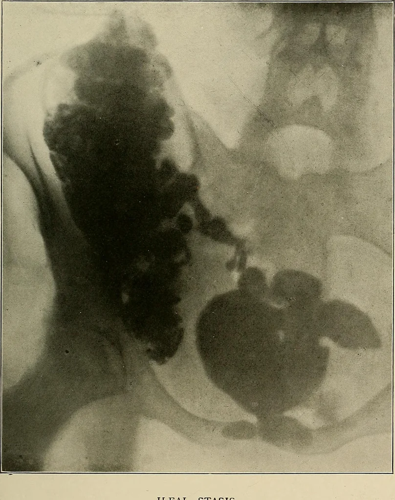An illustration from A text-book of radiology, 1915, leaf 234