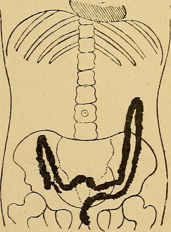 An illustration from A text-book of radiology, 1915, leaf 240