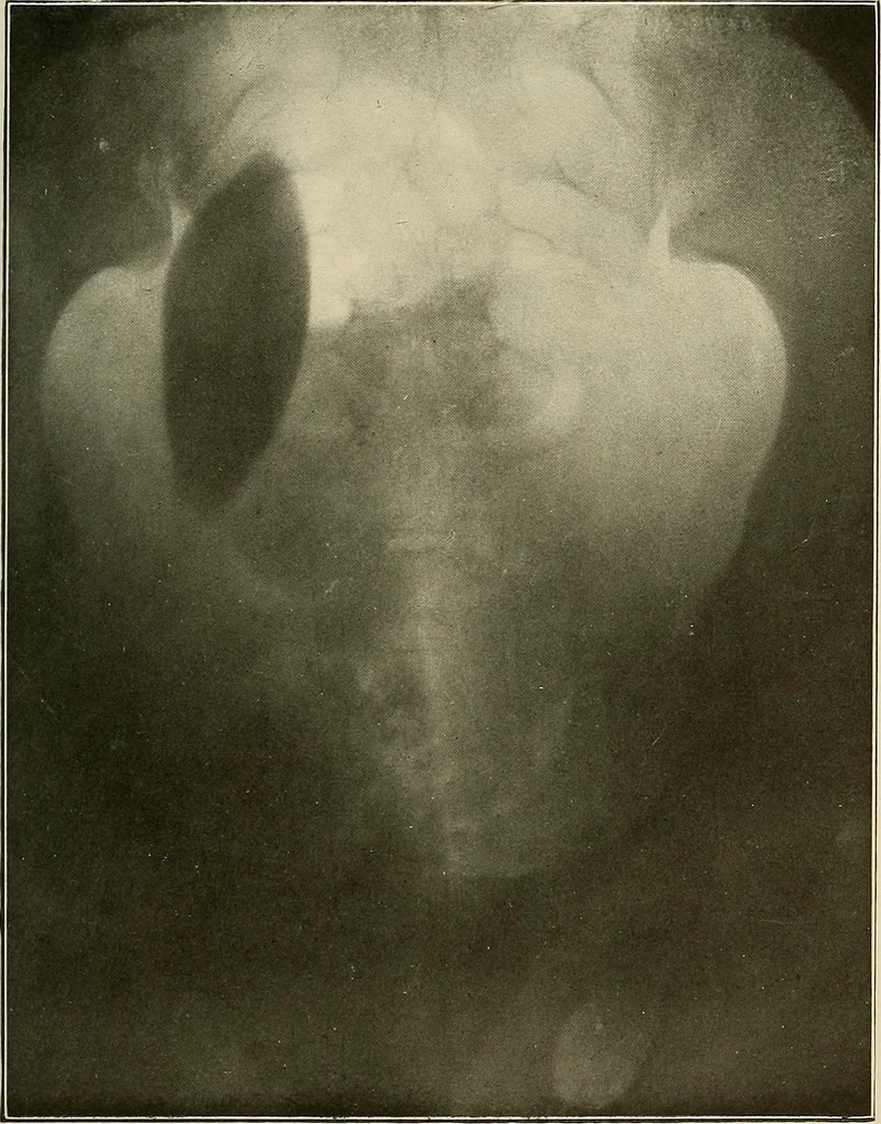 An illustration from A text-book of radiology, 1915, leaf 258