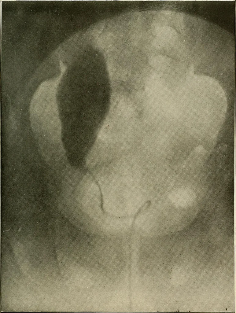 An illustration from A text-book of radiology, 1915, leaf 260
