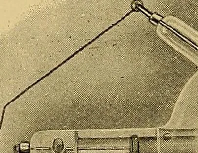An illustration from A text-book of radiology, 1915, leaf 67
