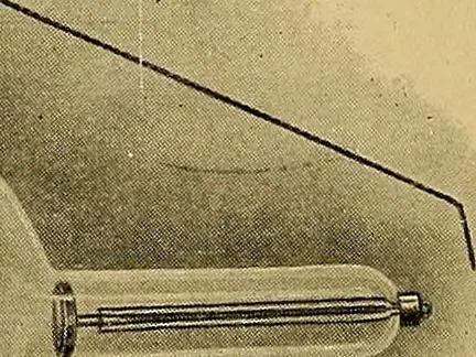 An illustration from A text-book of radiology, 1915, leaf 67