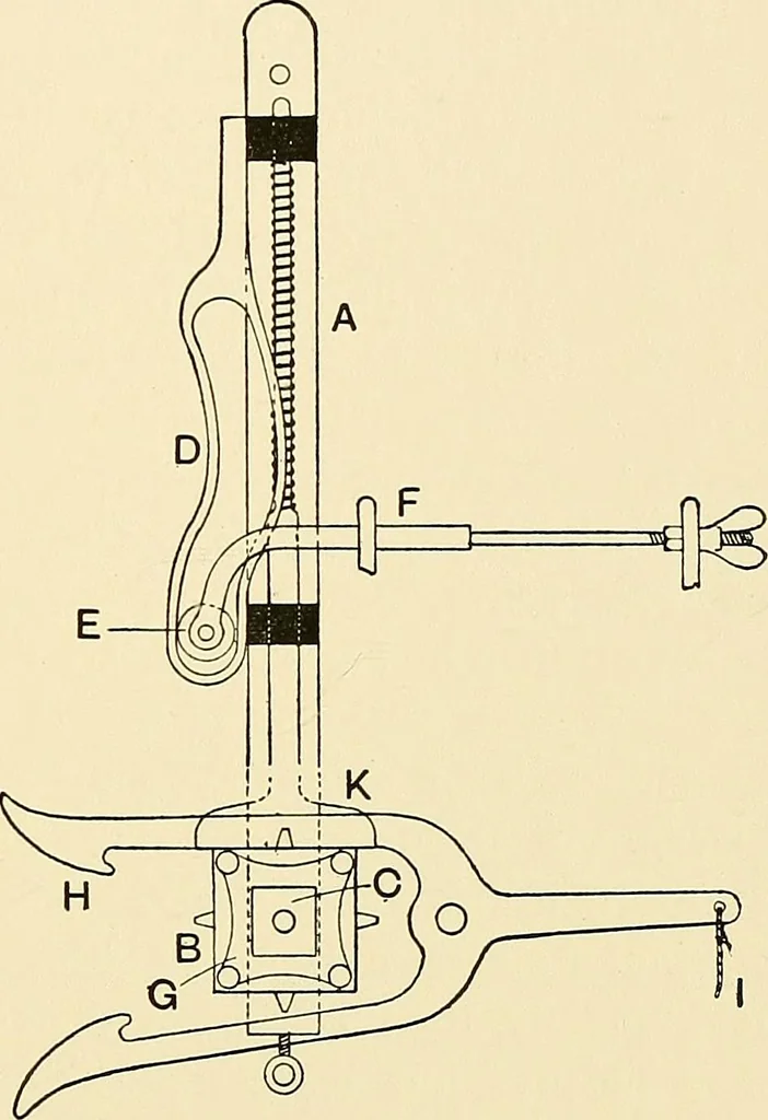 An illustration from The textile industries : a practical guide to fibres, yarns & fabrics in every branch of textile manufacture, including preparation of fibres, spinning, doubling, designing, weaving, bleaching, printing, dyeing and finishing, 1910, leaf 88