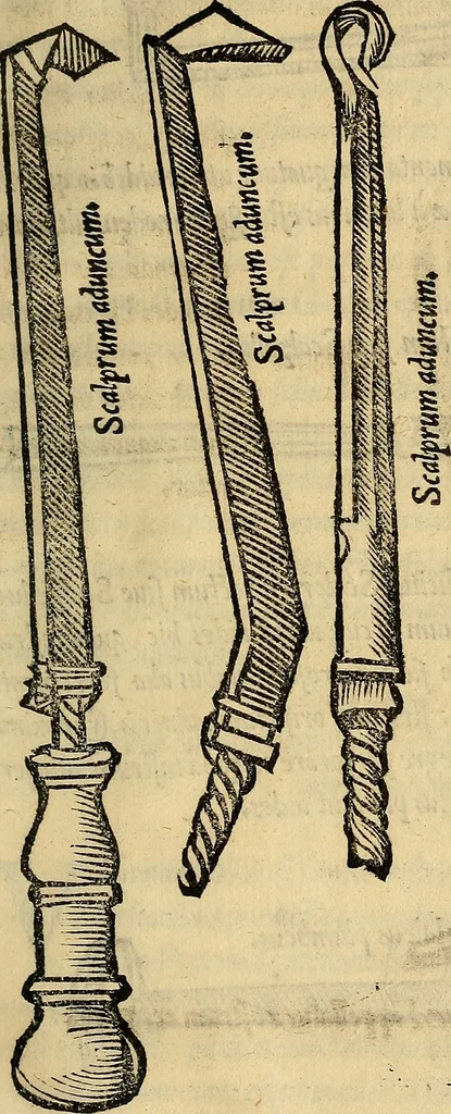 An illustration from Tractatus perutilis et completus de fractura cranei, 1535, leaf 200