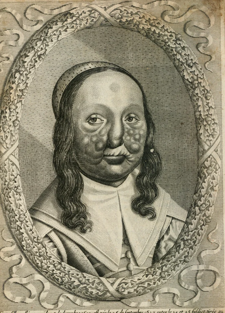 An illustration from Traicté povr la conservation de la santé, et svr la saignee de ce temps, et moyen de remedier aux maladies sans craincte de leur recheute : auec autres traictez necessaires pour toutes sortes de personnes, en façon & ordre non encores veus, & selon la doctrine des anciens medecins grecs, arabes, latins & françois : avgmenté d'vn Traicté de Galien, de l'alictement des malades : Apologie contre Iean Terud ... : Examen du liure intitulé Medecin charitable : Traicté de la physiognomie, auec les figures propres, qui sont au nombre de 53 ..., 1650, leaf 735
