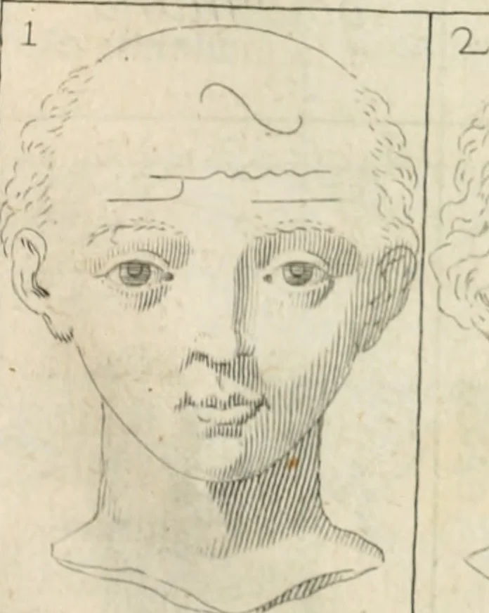 An illustration from Traicté povr la conservation de la santé, et svr la saignee de ce temps, et moyen de remedier aux maladies sans craincte de leur recheute : auec autres traictez necessaires pour toutes sortes de personnes, en façon & ordre non encores veus, & selon la doctrine des anciens medecins grecs, arabes, latins & françois : avgmenté d'vn Traicté de Galien, de l'alictement des malades : Apologie contre Iean Terud ... : Examen du liure intitulé Medecin charitable : Traicté de la physiognomie, auec les figures propres, qui sont au nombre de 53 ..., 1650, leaf 742