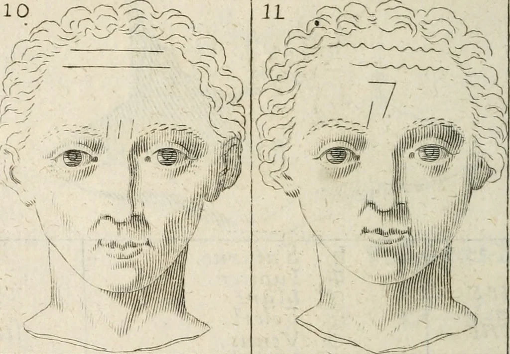 An illustration from Traicté povr la conservation de la santé, et svr la saignee de ce temps, et moyen de remedier aux maladies sans craincte de leur recheute : auec autres traictez necessaires pour toutes sortes de personnes, en façon & ordre non encores veus, & selon la doctrine des anciens medecins grecs, arabes, latins & françois : avgmenté d'vn Traicté de Galien, de l'alictement des malades : Apologie contre Iean Terud ... : Examen du liure intitulé Medecin charitable : Traicté de la physiognomie, auec les figures propres, qui sont au nombre de 53 ..., 1650, leaf 743