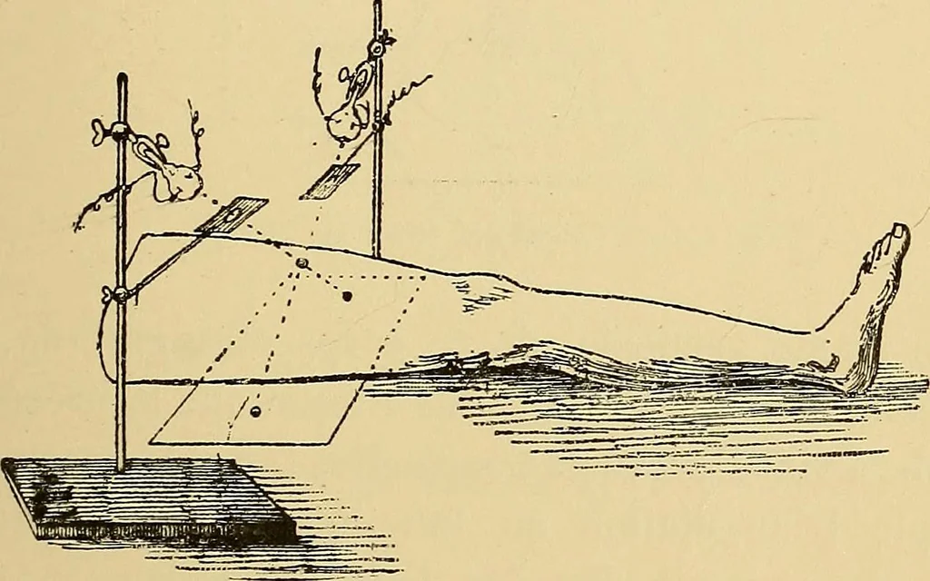 An illustration from Traité de radiographie médicale et scientifique : cours libre professé a l'écolepratique de la Faculté de Médecine de Paris, deuxième semestre de 1896-1897, 1897, leaf 314