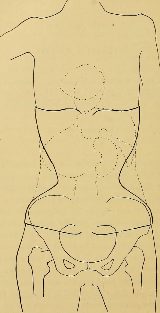 An illustration from Traité de radiographie médicale et scientifique : cours libre professé a l'écolepratique de la Faculté de Médecine de Paris, deuxième semestre de 1896-1897, 1897, leaf 339