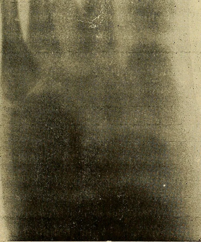 An illustration from Traité de radiographie médicale et scientifique : cours libre professé a l'écolepratique de la Faculté de Médecine de Paris, deuxième semestre de 1896-1897, 1897, leaf 352