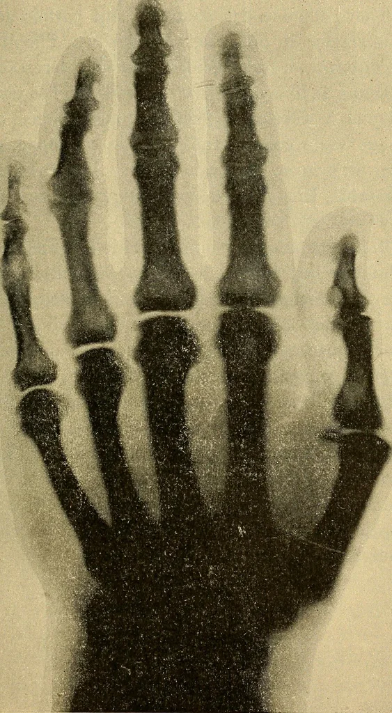 An illustration from Traité de radiographie médicale et scientifique : cours libre professé a l'écolepratique de la Faculté de Médecine de Paris, deuxième semestre de 1896-1897, 1897, leaf 356