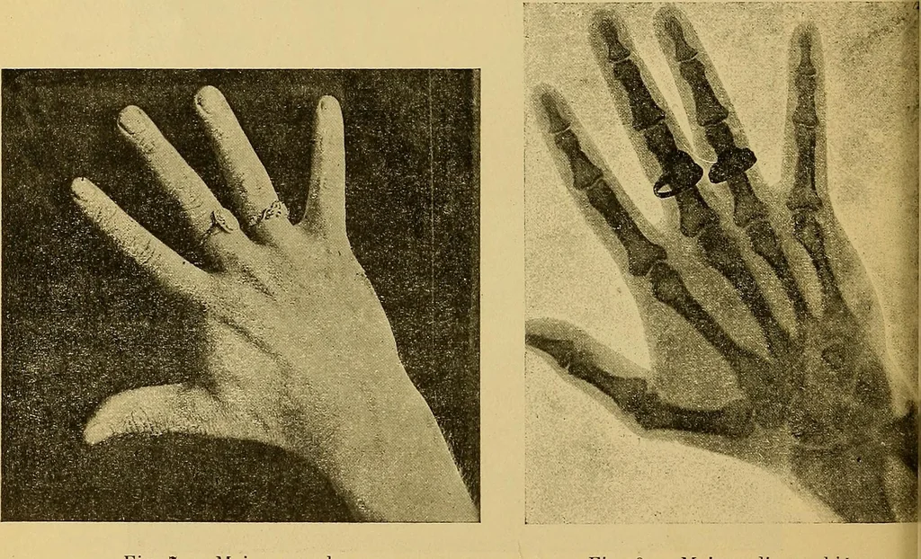 An illustration from Traité de radiographie médicale et scientifique : cours libre professé a l'écolepratique de la Faculté de Médecine de Paris, deuxième semestre de 1896-1897, 1897, leaf 37